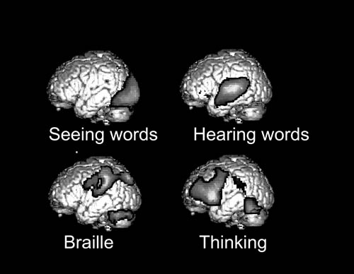 Graphic of regions of the brain dedicated to sight, hearing, critical thinking